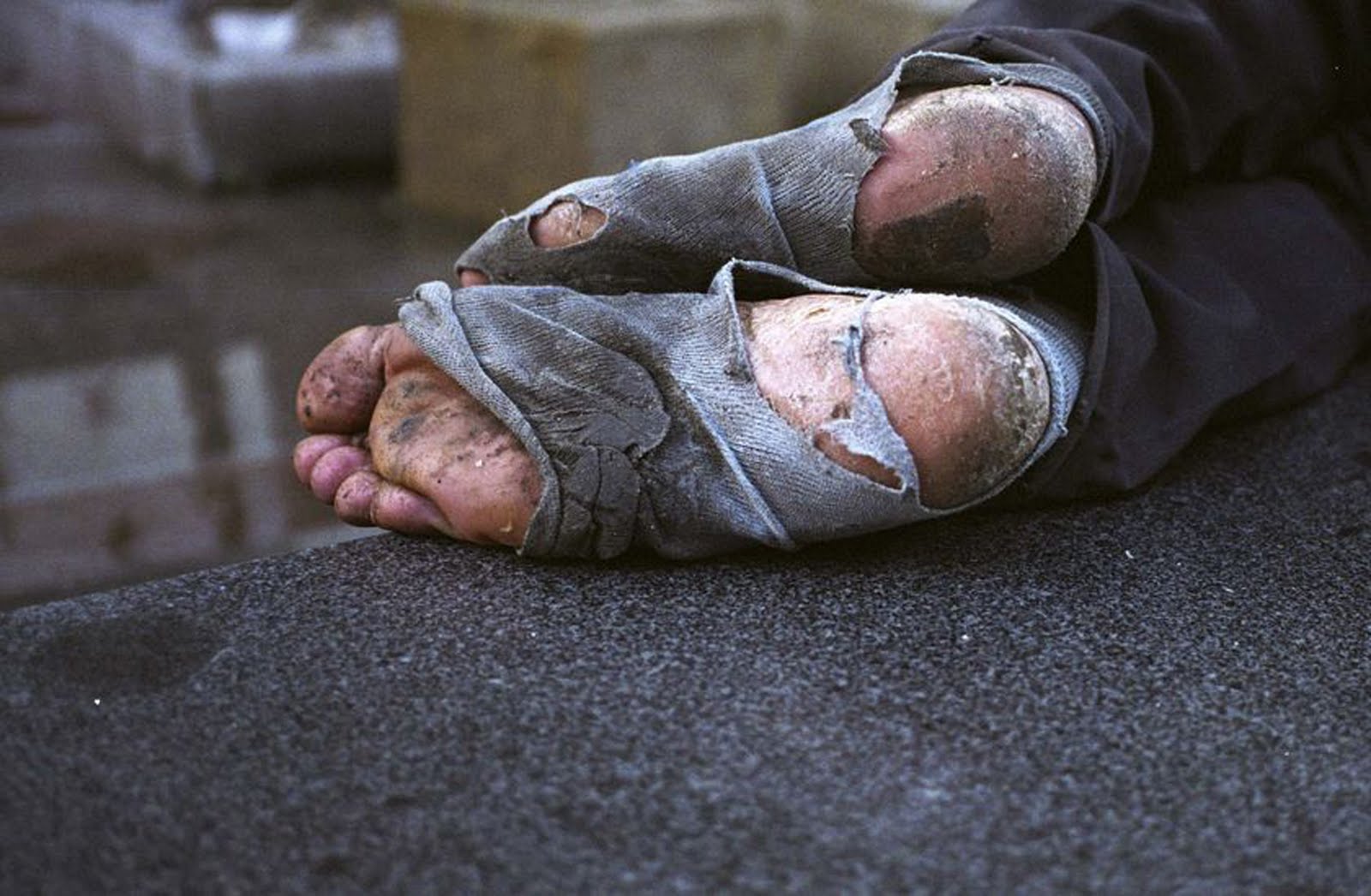 homeless foot.jpg